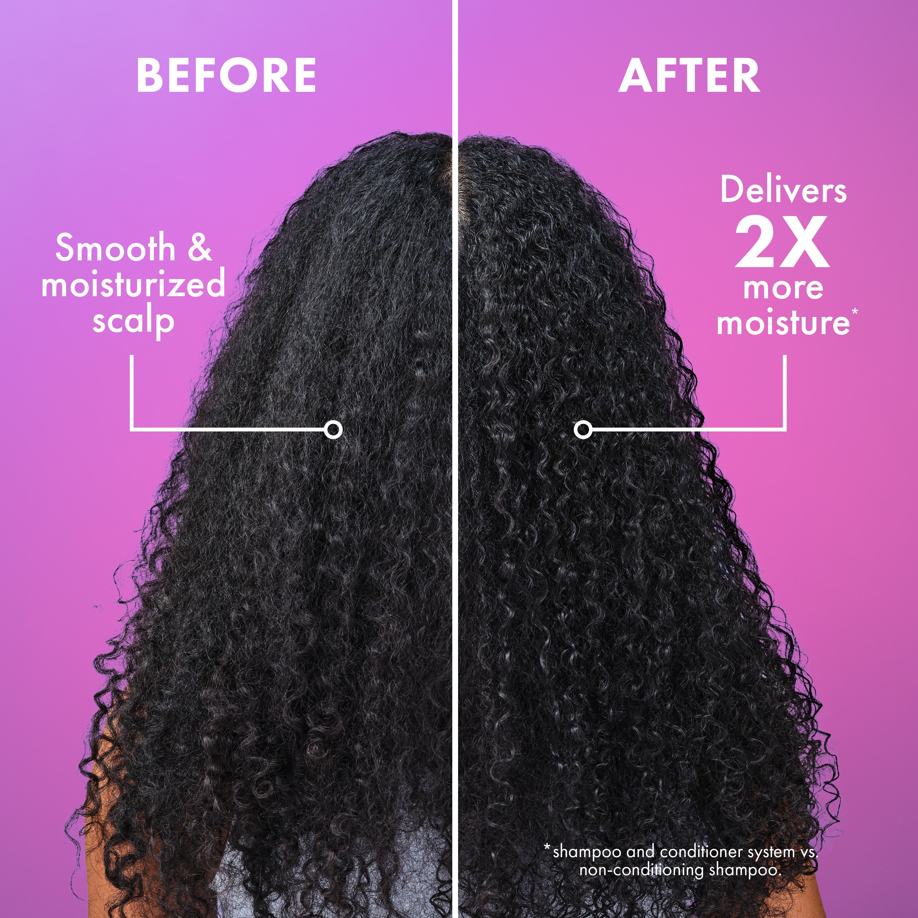 Lavender & Lychee Daily Scalp Moisturizing Lotion